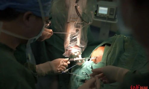 哺乳期可以吃山楂水网 - 山楂产妇哺乳期可以吃吗,哺乳期可以吃山楂水吗会回奶吗